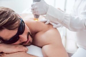 Laser-Hair-Removal